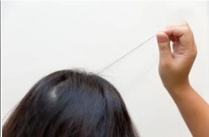 Qué es la tricotilomanía: causas, síntomas y tratamiento espacio calma tirarse el pelo